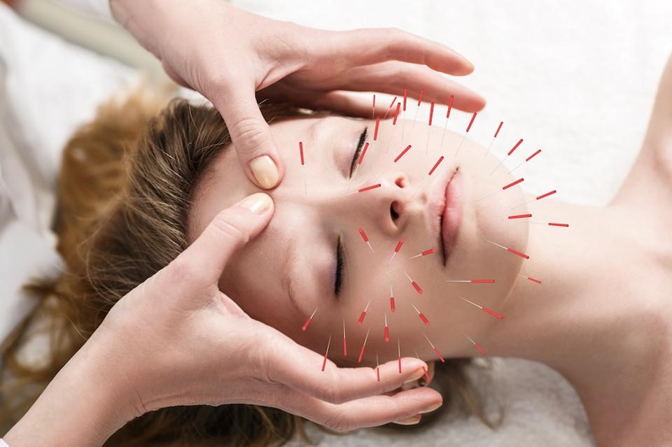 facial micro-needling treatment